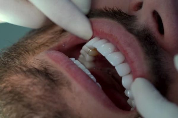 Expert Dentist Abbotsford Creating Brighter Smiles Every Day