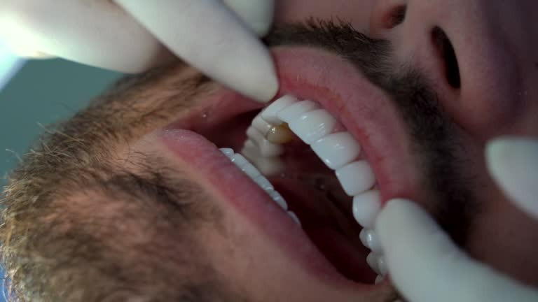 Expert Dentist Abbotsford Creating Brighter Smiles Every Day